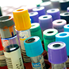 A close-up of various blood sample tubes with colored caps arranged in a holder, ready for laboratory testing with the PathFinder 350D.